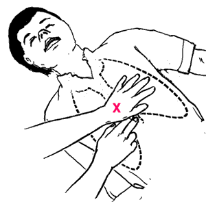 Положение рук при сердечно-легочной реанимации